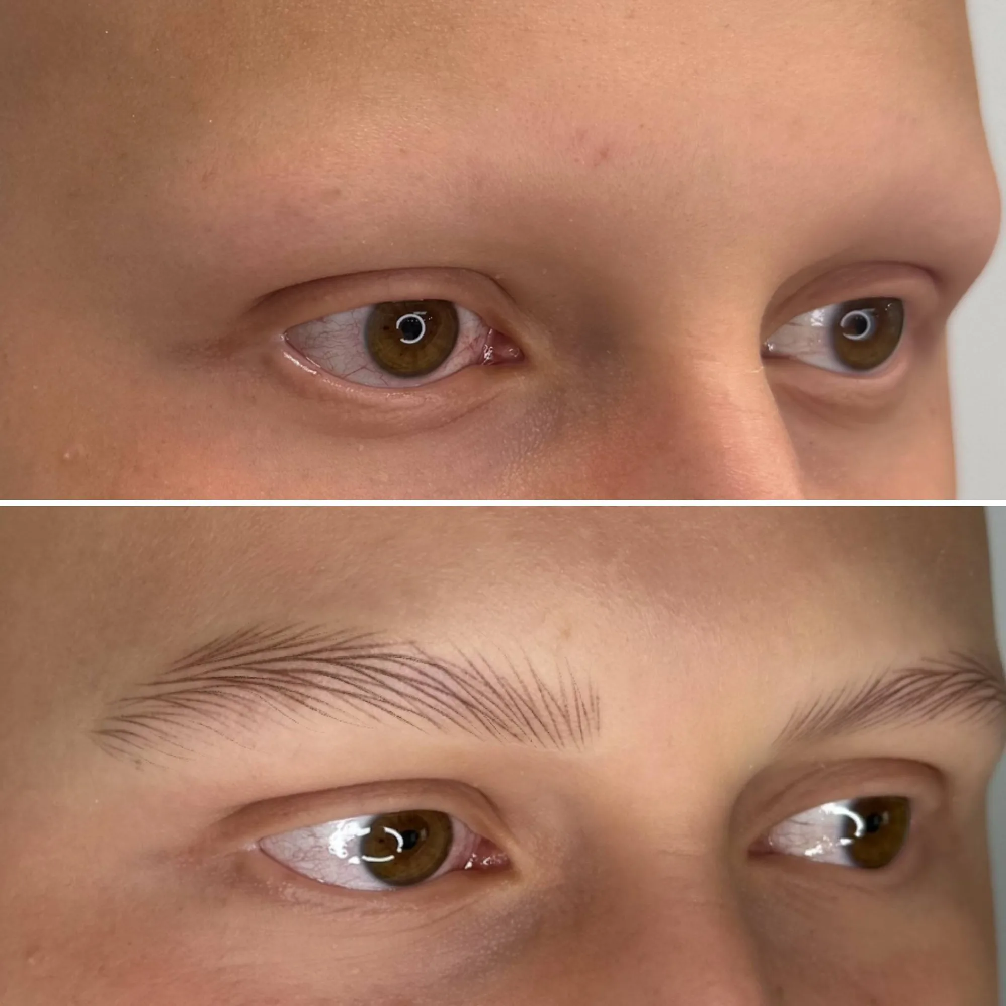 Alopeside Kalıcı Makyaj: Gerçekçi Kaşlarla Özgüven
